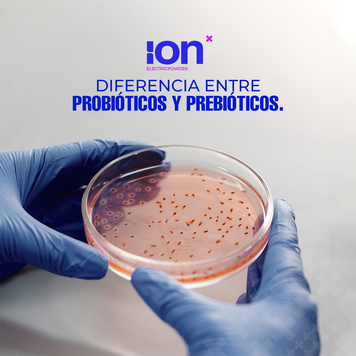 Diferencia entre probióticos y prebióticos